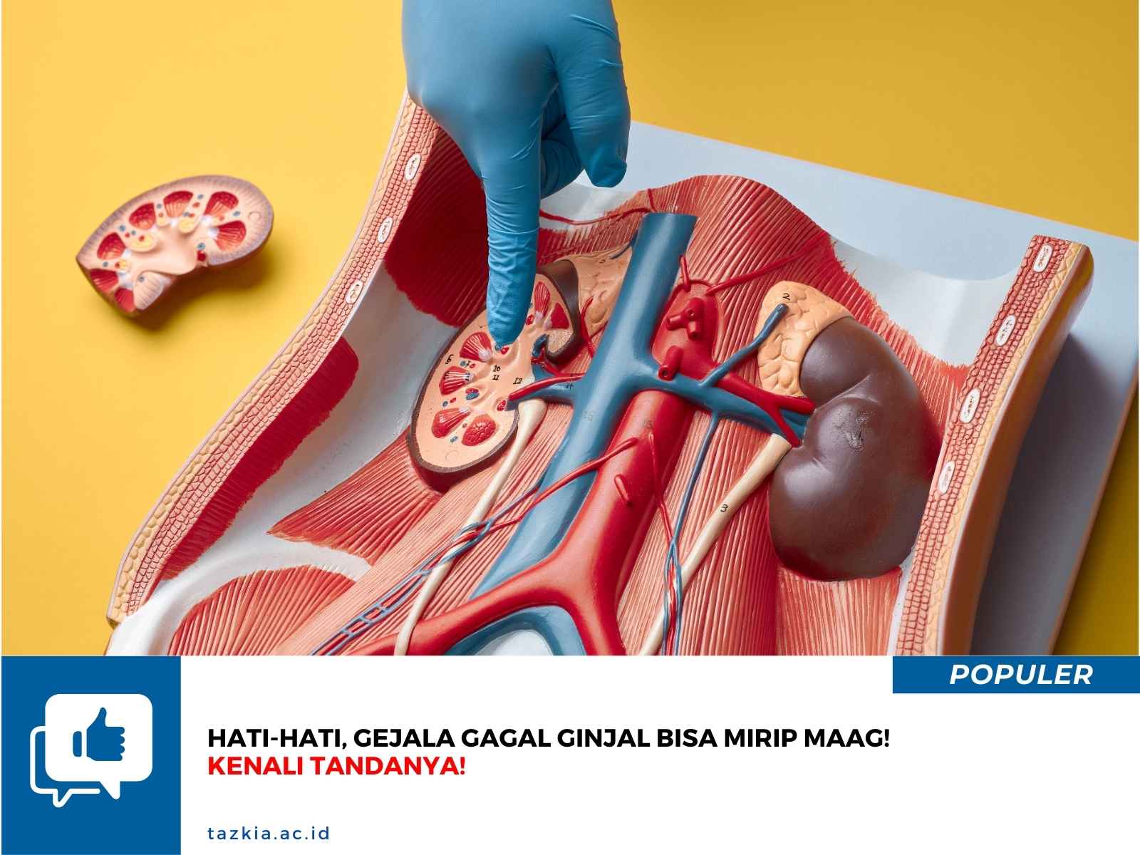 Hati Hati Gejala Gagal Ginjal Bisa Mirip Maag Kenali Tandanya